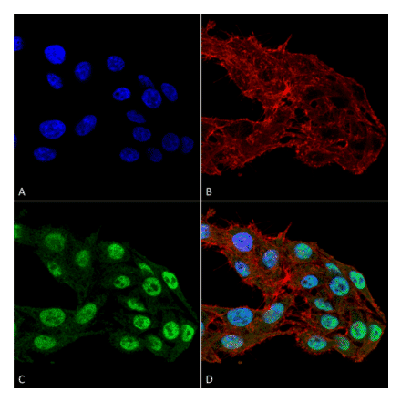 Immunocytochemistry/Immunofluorescence - Anti-DNMT1 Antibody [11H8] (A304714) - Antibodies.com