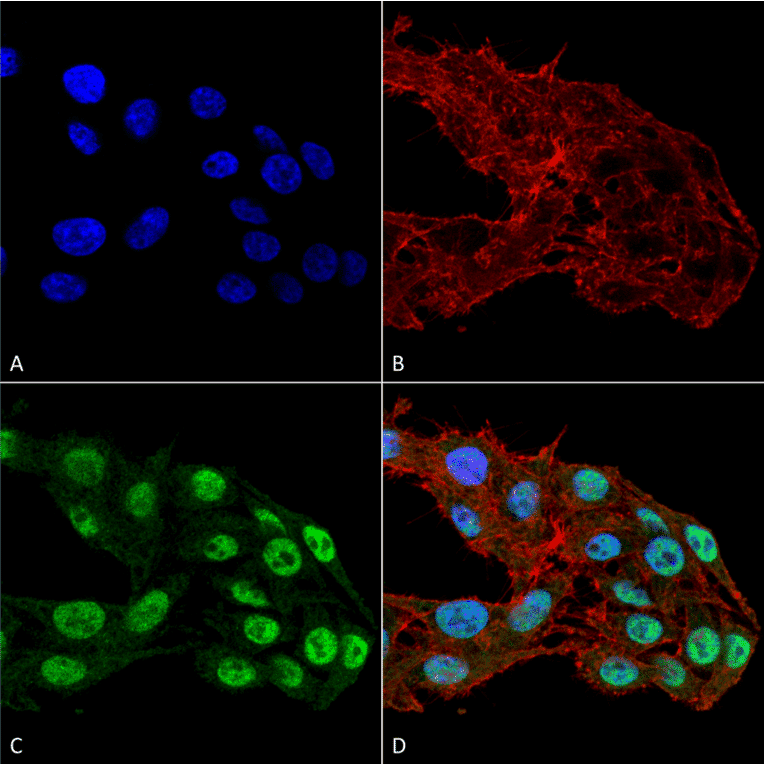 Immunocytochemistry/Immunofluorescence - Anti-DNMT1 Antibody [11H8] (A304714) - Antibodies.com