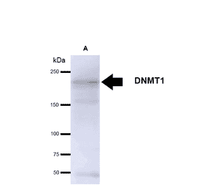 Western Blot - Anti-DNMT1 Antibody [60B1220.1] (A304715) - Antibodies.com
