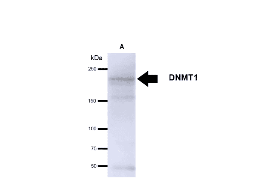 Western Blot - Anti-DNMT1 Antibody [60B1220.1] (A304715) - Antibodies.com