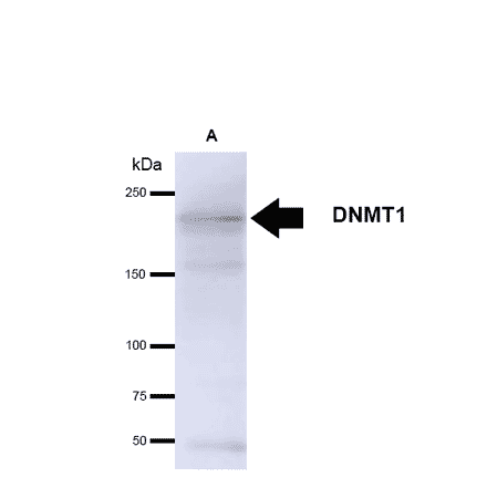 Western Blot - Anti-DNMT1 Antibody [60B1220.1] (A304715) - Antibodies.com