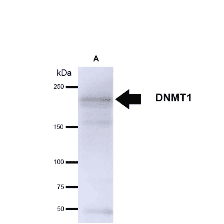 Western Blot - Anti-DNMT1 Antibody [60B1220.1] (A304715) - Antibodies.com