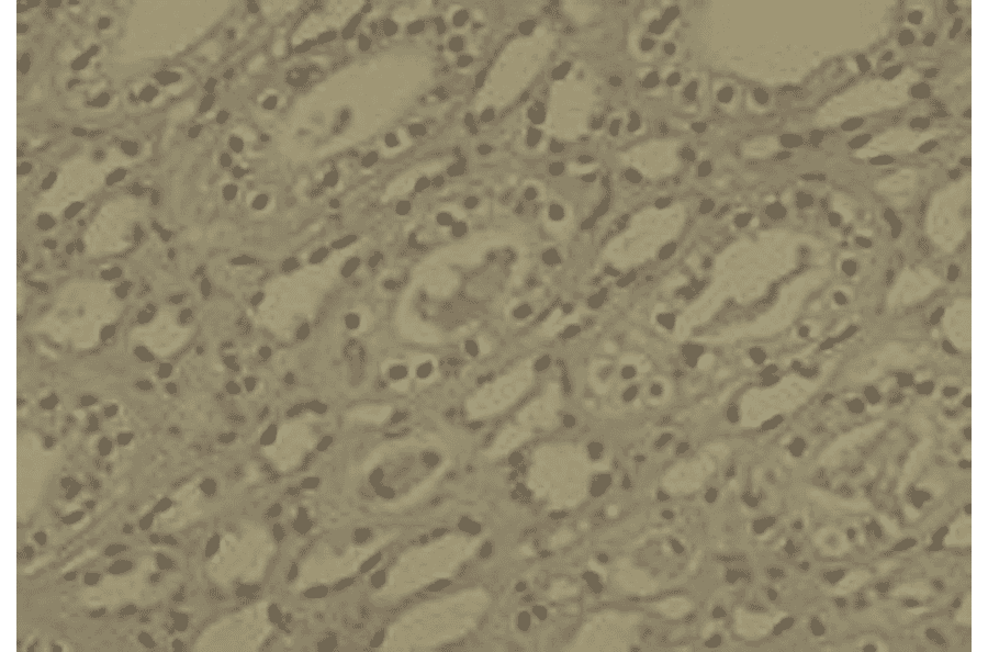 Immunohistochemistry - Anti-DNMT1 Antibody [60B1220.1] (A304715) - Antibodies.com