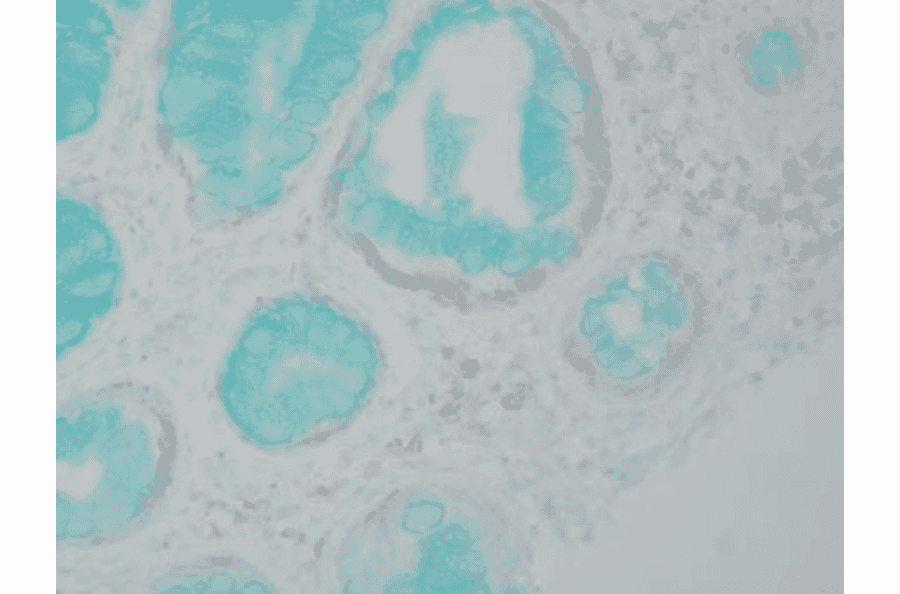 Immunohistochemistry - Anti-DNMT1 Antibody [60B1220.1] (A304715) - Antibodies.com