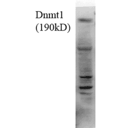 Western Blot - Anti-DNMT1 Antibody [4G11-C7] (A304716) - Antibodies.com