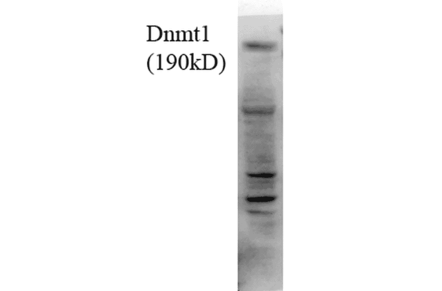 Western Blot - Anti-DNMT1 Antibody [4G11-C7] (A304716) - Antibodies.com