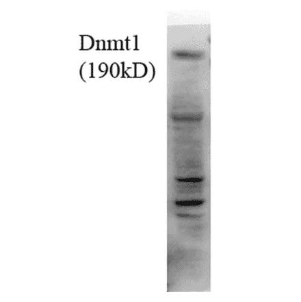 Western Blot - Anti-DNMT1 Antibody [4G11-C7] (A304716) - Antibodies.com