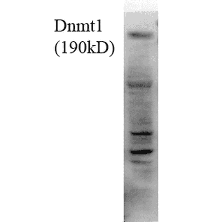 Western Blot - Anti-DNMT1 Antibody [4G11-C7] (A304716) - Antibodies.com