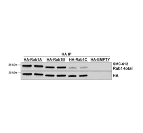 Immunoprecipitation - Anti-Rab1A Antibody [7H4] (A304718) - Antibodies.com