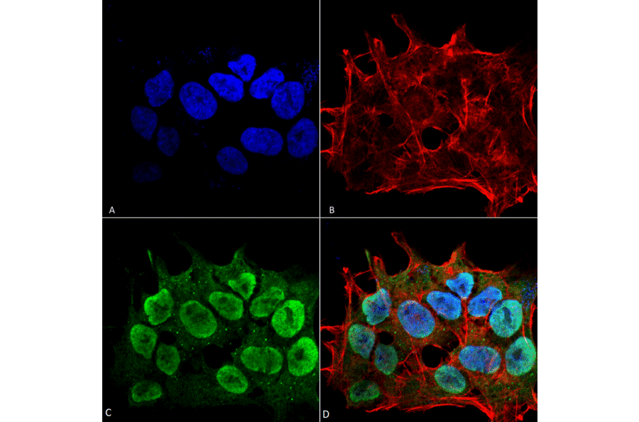 Immunocytochemistry/Immunofluorescence - Anti-SHANK3 Antibody [S367-51] (A304719) - Antibodies.com