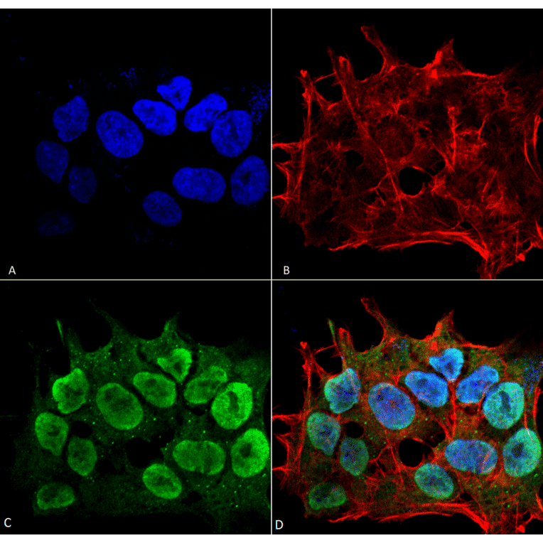 Immunocytochemistry/Immunofluorescence - Anti-SHANK3 Antibody [S367-51] (A304719) - Antibodies.com