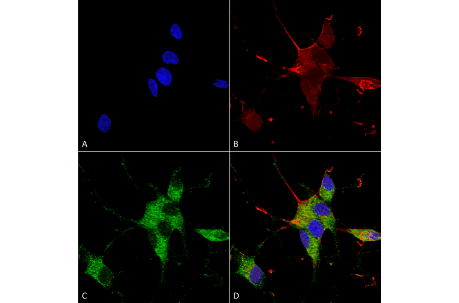 Immunocytochemistry/Immunofluorescence - Anti-SHANK3 Antibody [S367-51] (A304719) - Antibodies.com