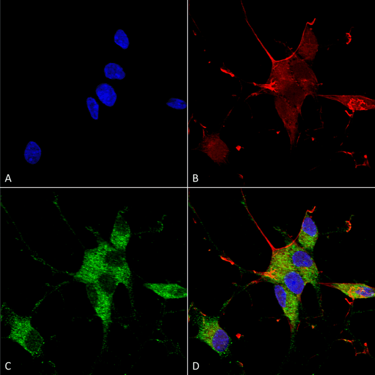 Immunocytochemistry/Immunofluorescence - Anti-SHANK3 Antibody [S367-51] (A304719) - Antibodies.com