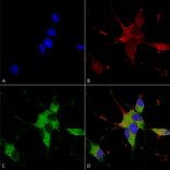 Immunocytochemistry/Immunofluorescence - Anti-SHANK3 Antibody [S367-51] (A304719) - Antibodies.com