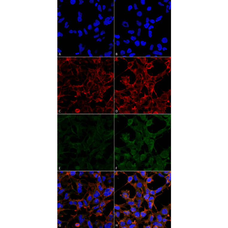 Immunocytochemistry/Immunofluorescence - Anti-4-Hydroxynonenal Antibody [12F7] (A304722) - Antibodies.com