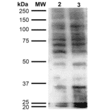 Western Blot - Anti-Hexanoyl-Lysine adduct Antibody [5D9] (A304725) - Antibodies.com