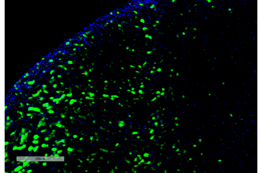 Immunohistochemistry - Anti-Hexanoyl-Lysine adduct Antibody [5D9] (A304725) - Antibodies.com