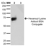Western Blot - Anti-Hexanoyl-Lysine adduct Antibody [5E8] (A304726) - Antibodies.com