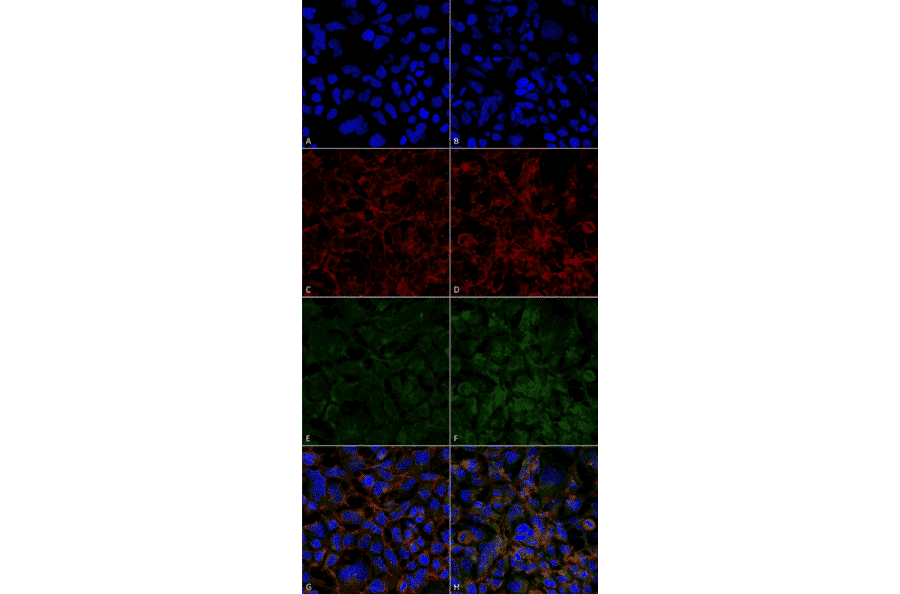 Immunocytochemistry/Immunofluorescence - Anti-Hexanoyl-Lysine adduct Antibody [5E8] (A304726) - Antibodies.com