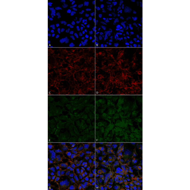 Immunocytochemistry/Immunofluorescence - Anti-Hexanoyl-Lysine adduct Antibody [5E8] (A304726) - Antibodies.com