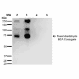 Western Blot - Anti-Malondialdehyde Antibody [11E3] (A304727) - Antibodies.com