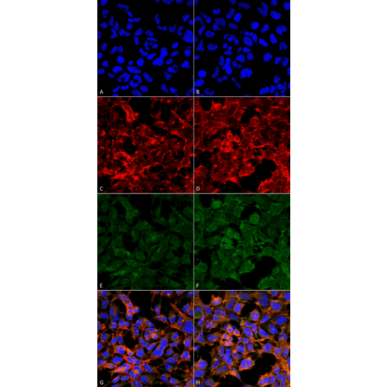 Immunocytochemistry/Immunofluorescence - Anti-Malondialdehyde Antibody [11E3] (A304727) - Antibodies.com