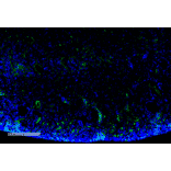 Immunohistochemistry - Anti-Malondialdehyde Antibody [11E3] (A304727) - Antibodies.com