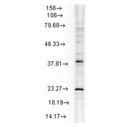 Western Blot - Anti-HSP22 Antibody [3C12-H11] (A304735) - Antibodies.com