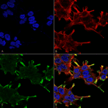 Immunocytochemistry/Immunofluorescence - Anti-alpha B Crystallin Antibody [1A7.D5] (A304737) - Antibodies.com