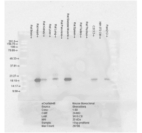 Western Blot - Anti-alpha B Crystallin Antibody [3A10.C9] (A304738) - Antibodies.com