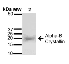 Western Blot - Anti-alpha B Crystallin Antibody (A304739) - Antibodies.com