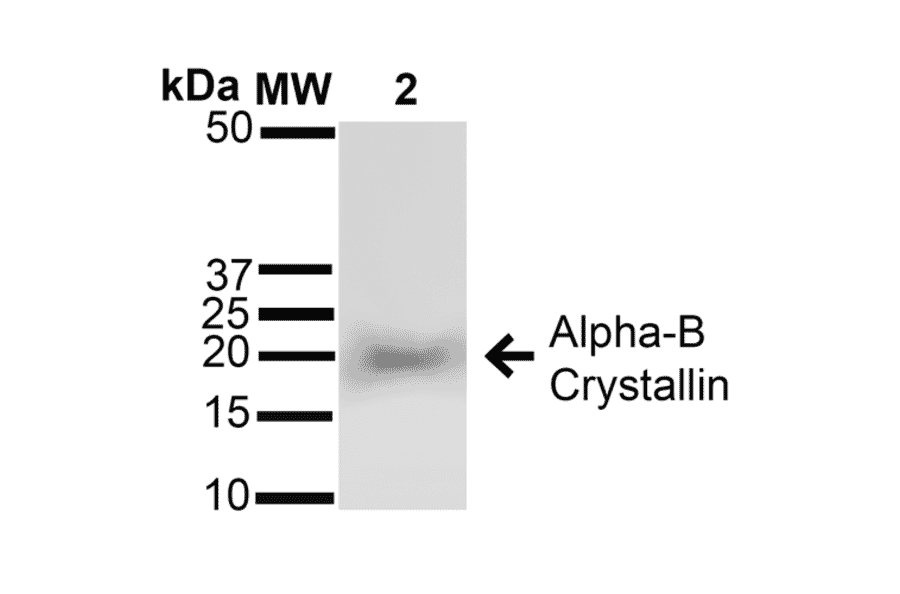 Western Blot - Anti-alpha B Crystallin Antibody (A304739) - Antibodies.com