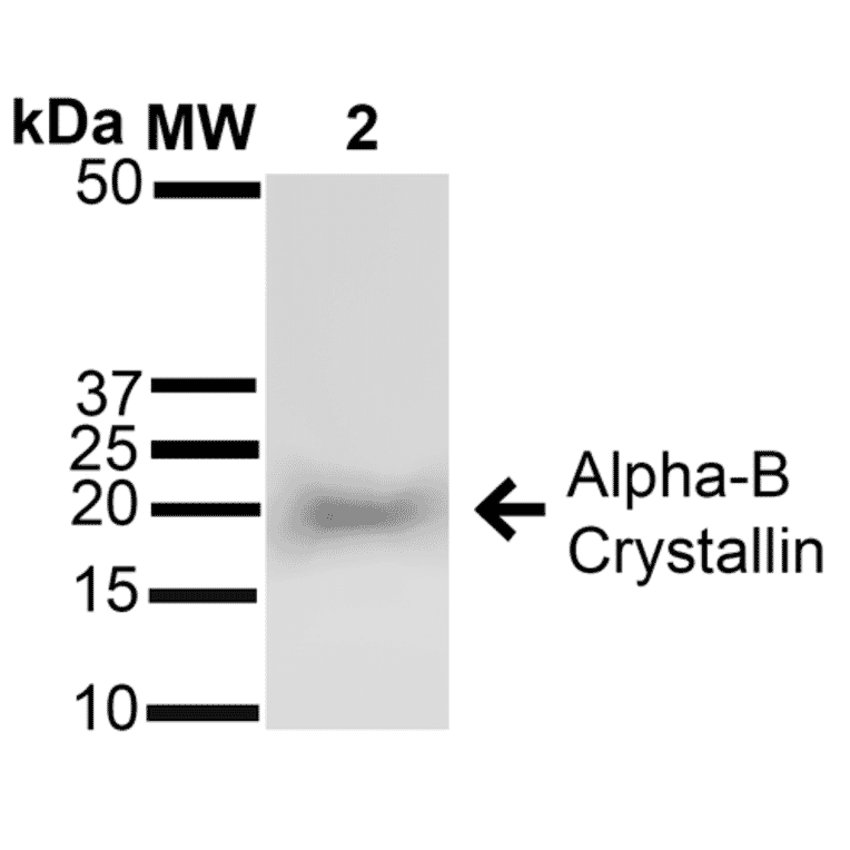 Western Blot - Anti-alpha B Crystallin Antibody (A304739) - Antibodies.com