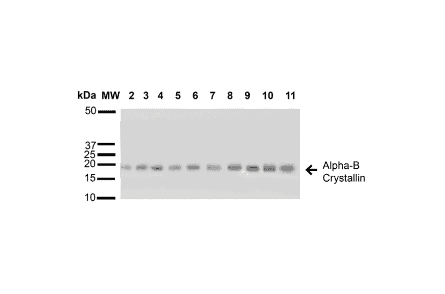 Western Blot - Anti-alpha B Crystallin Antibody (A304739) - Antibodies.com