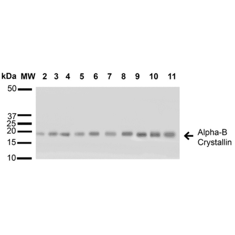 Western Blot - Anti-alpha B Crystallin Antibody (A304739) - Antibodies.com
