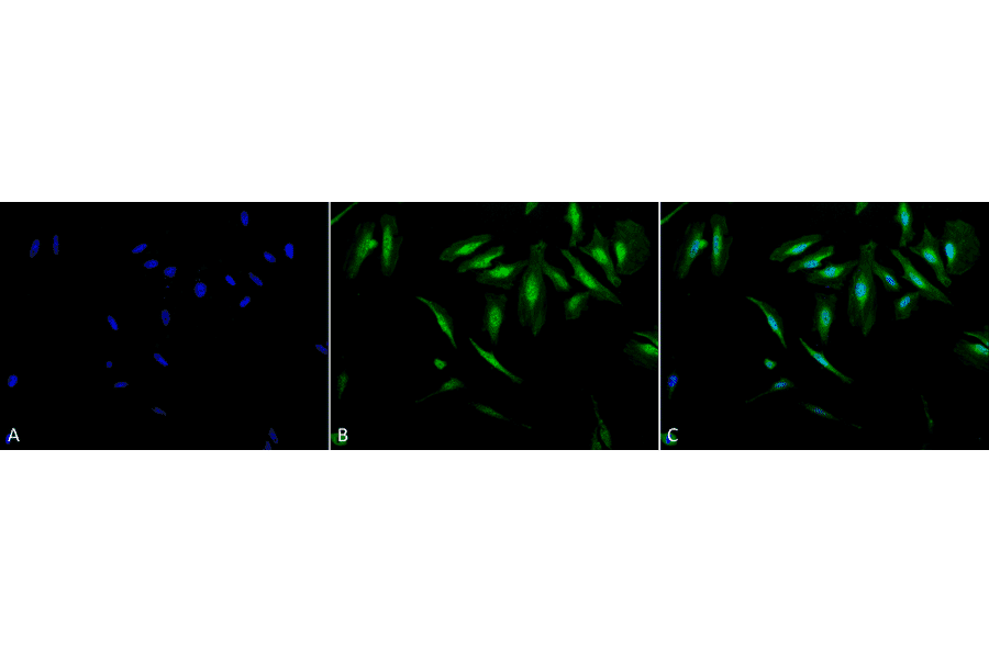 Immunocytochemistry/Immunofluorescence - Anti-alpha B Crystallin Antibody (A304739) - Antibodies.com