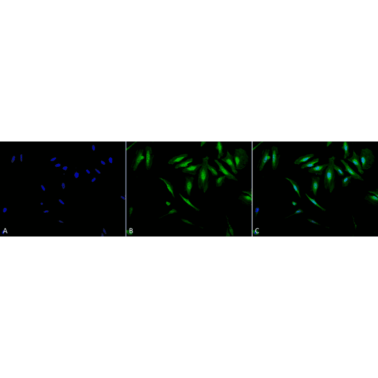 Immunocytochemistry/Immunofluorescence - Anti-alpha B Crystallin Antibody (A304739) - Antibodies.com