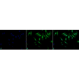 Immunocytochemistry/Immunofluorescence - Anti-alpha B Crystallin Antibody (A304739) - Antibodies.com