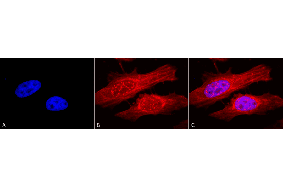 Immunocytochemistry/Immunofluorescence - Anti-alpha B Crystallin Antibody (A304739) - Antibodies.com