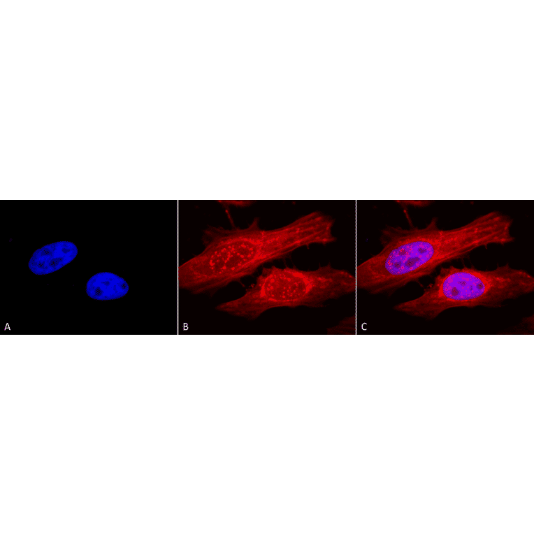 Immunocytochemistry/Immunofluorescence - Anti-alpha B Crystallin Antibody (A304739) - Antibodies.com