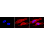 Immunocytochemistry/Immunofluorescence - Anti-alpha B Crystallin Antibody (A304739) - Antibodies.com