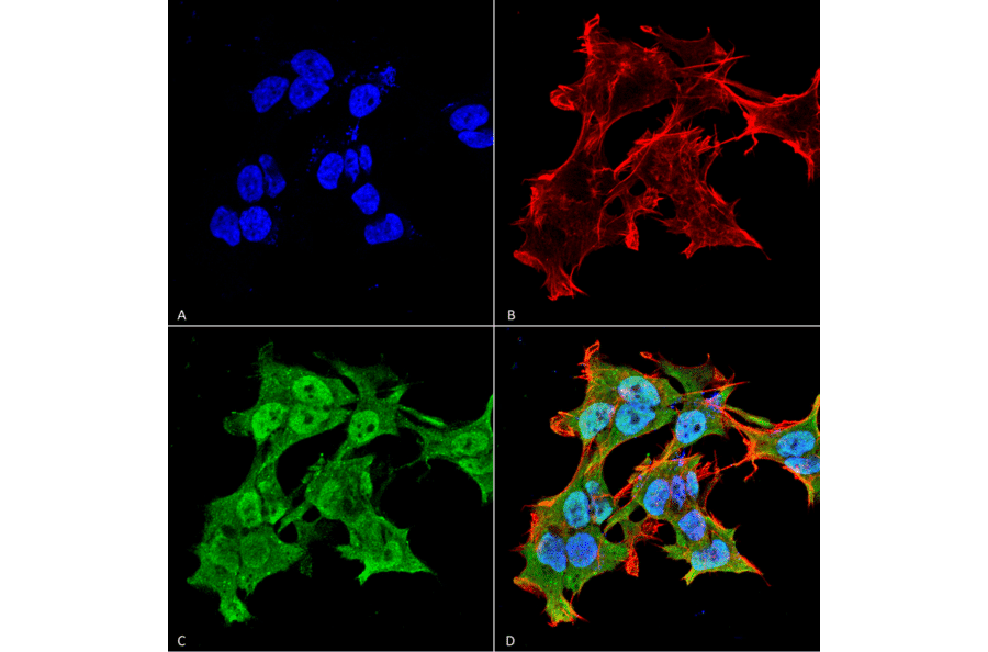 Immunocytochemistry/Immunofluorescence - Anti-alpha A Crystallin Antibody [1H3.B8] (A304740) - Antibodies.com