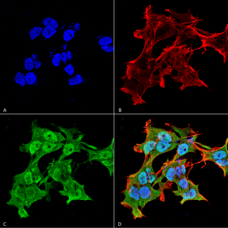 Immunocytochemistry/Immunofluorescence - Anti-alpha A Crystallin Antibody [1H3.B8] (A304740) - Antibodies.com
