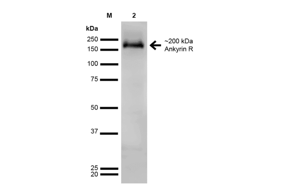 Western Blot - Anti-Ankyrin erythroid / ANK Antibody [S388A-10] (A304741) - Antibodies.com