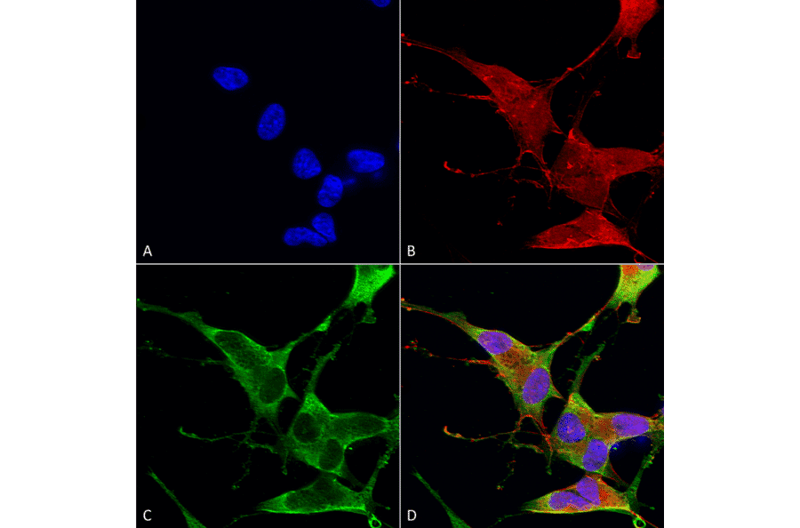 Immunocytochemistry/Immunofluorescence - Anti-Ankyrin erythroid / ANK Antibody [S388A-10] (A304741) - Antibodies.com