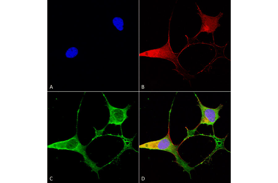Immunocytochemistry/Immunofluorescence - Anti-Ankyrin B Antibody [S105-13] (A304742) - Antibodies.com