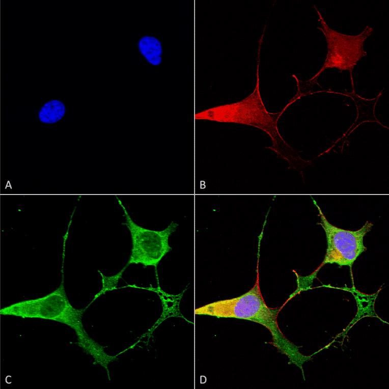Immunocytochemistry/Immunofluorescence - Anti-Ankyrin B Antibody [S105-13] (A304742) - Antibodies.com