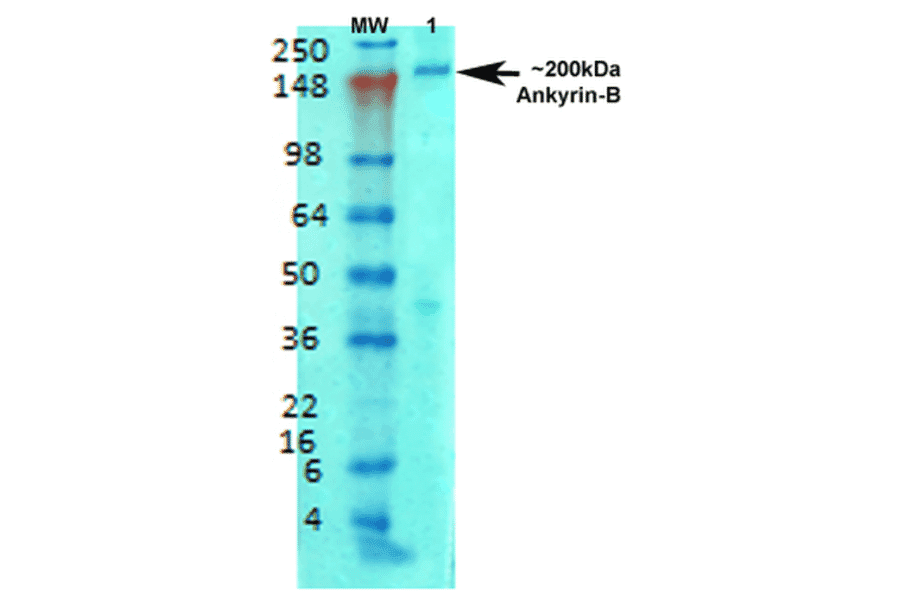 Western Blot - Anti-Ankyrin B Antibody [S105-13] (A304742) - Antibodies.com