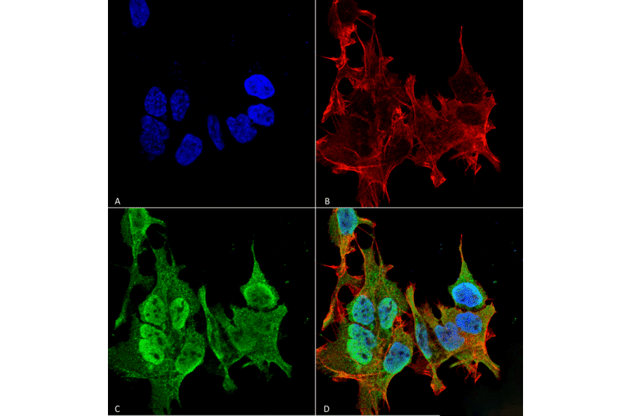 Immunocytochemistry/Immunofluorescence - Anti-Ankyrin B Antibody [S105-13] (A304742) - Antibodies.com