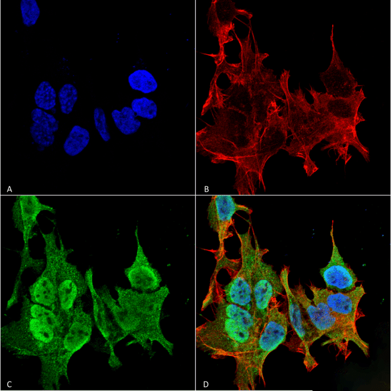 Immunocytochemistry/Immunofluorescence - Anti-Ankyrin B Antibody [S105-13] (A304742) - Antibodies.com